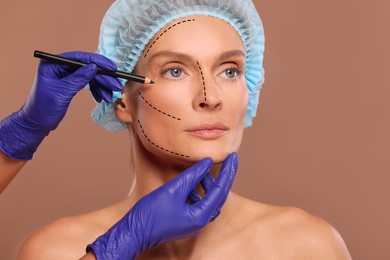 Woman preparing for cosmetic surgery, light brown background. Doctor drawing markings on her face, closeup