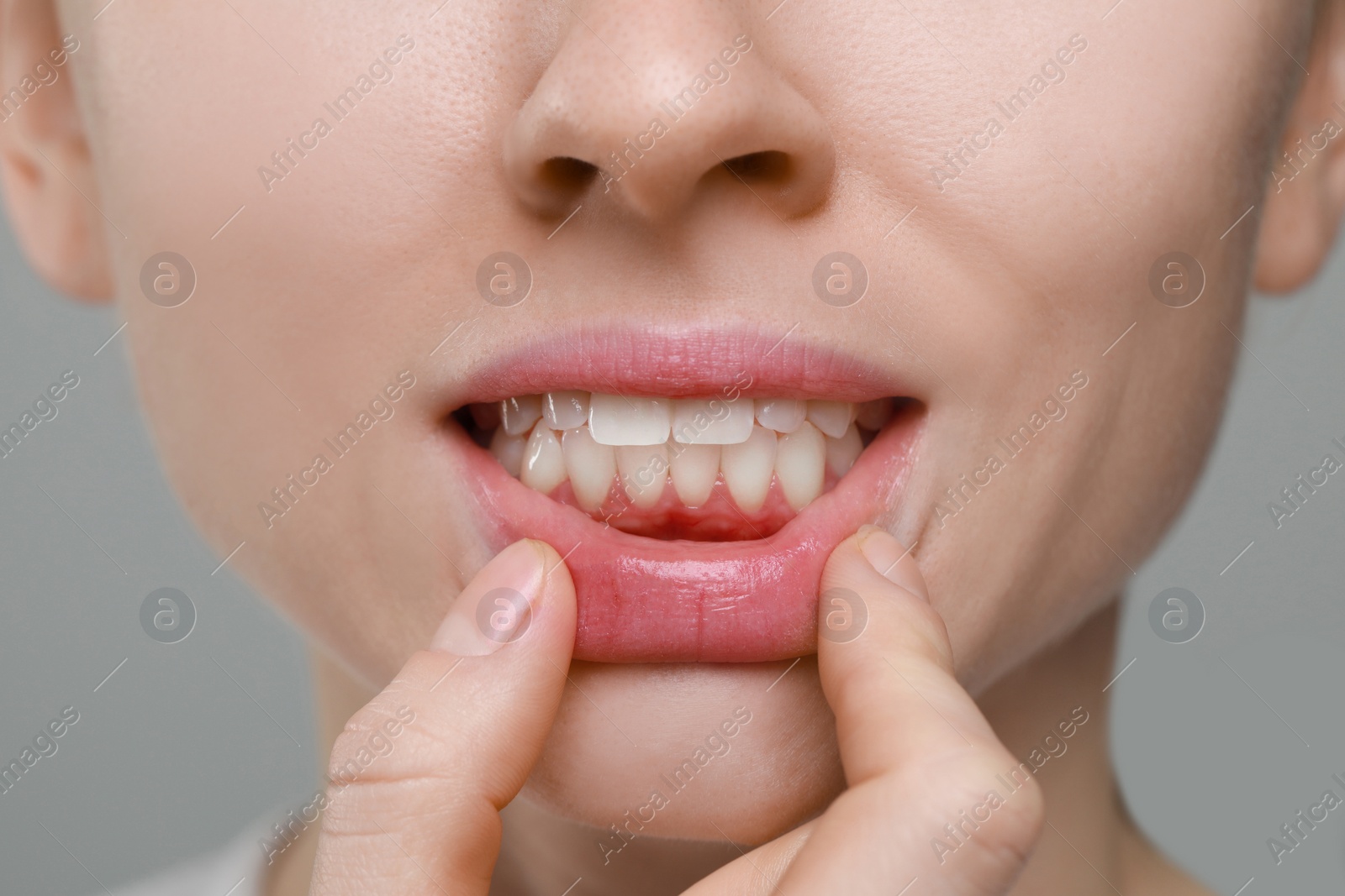 Photo of Woman showing healthy gums on grey background, closeup