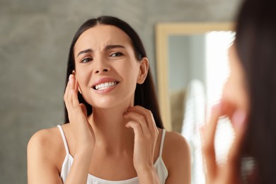 Suffering from allergy. Young woman scratching her neck near mirror indoors