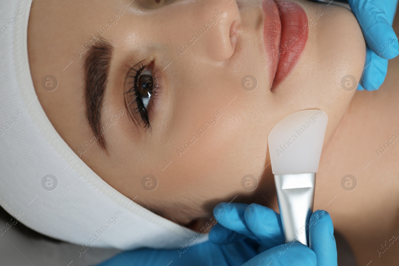 Photo of Young woman during face peeling procedure in salon, closeup