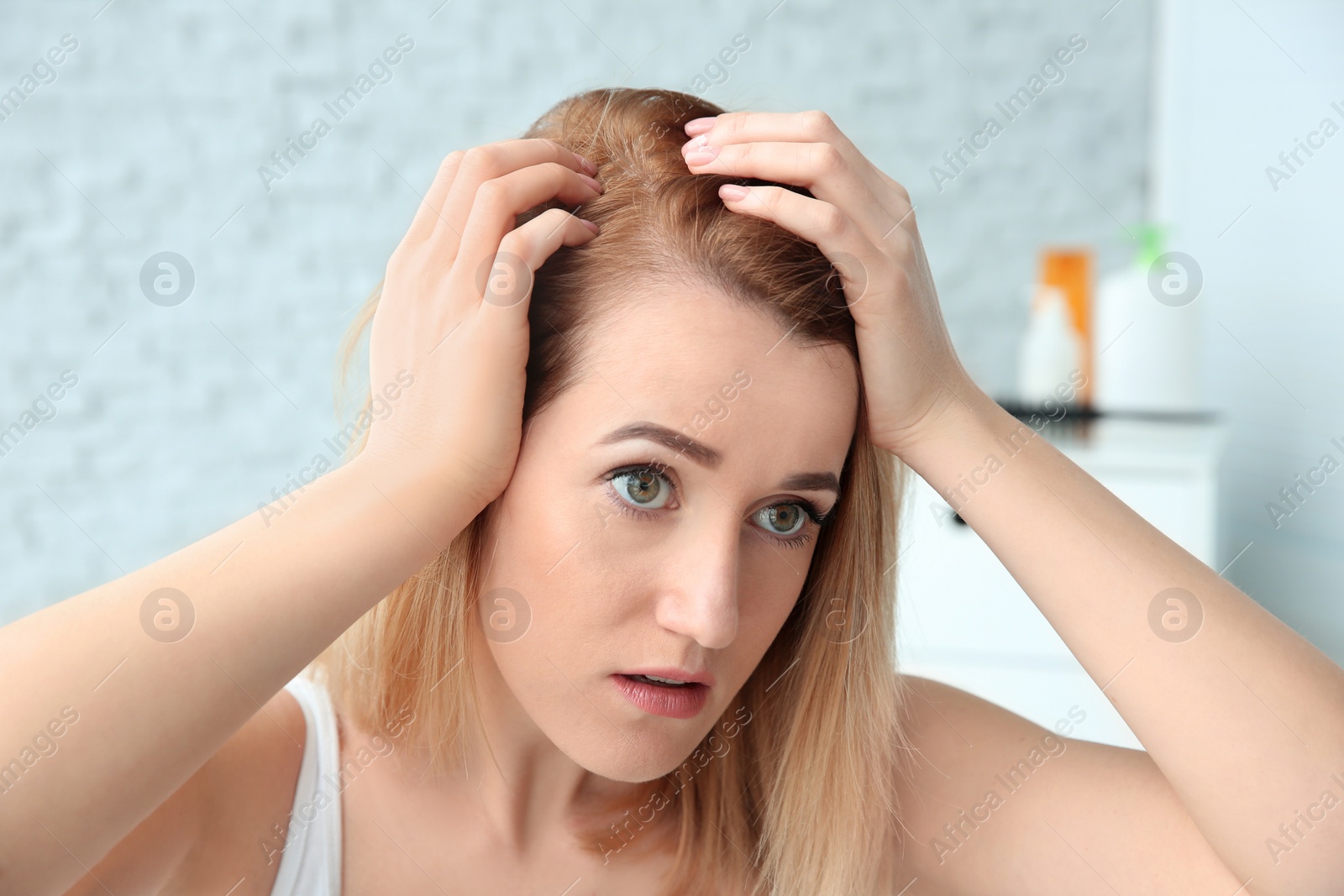 Photo of Young woman with hair loss problem at home