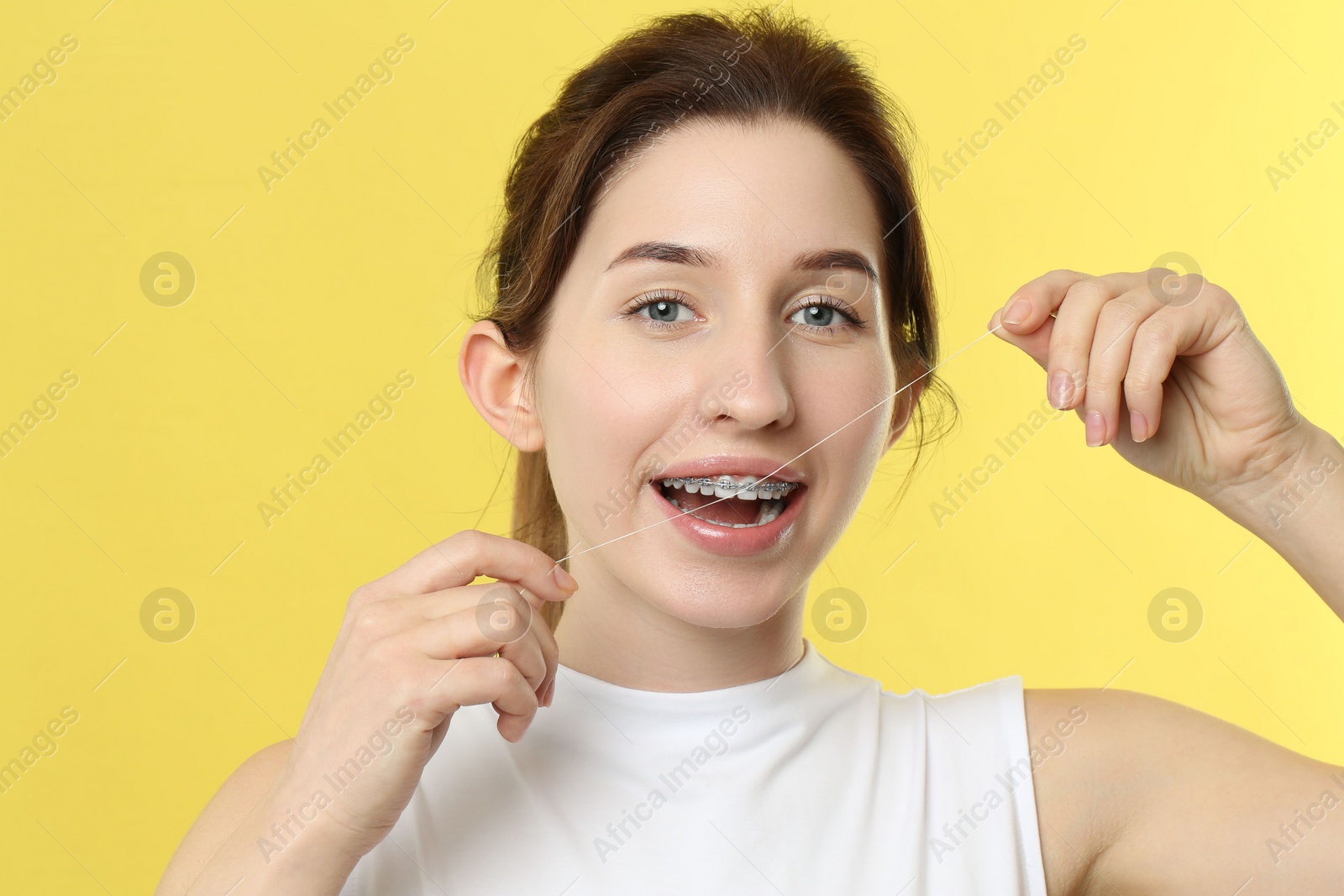 Photo of Smiling woman with braces cleaning teeth using dental floss on yellow background