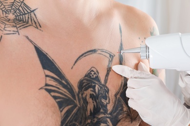 Man undergoing laser tattoo removal procedure in salon, closeup