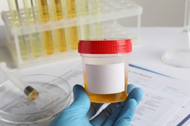 Nurse holding container with urine sample for analysis at table, closeup