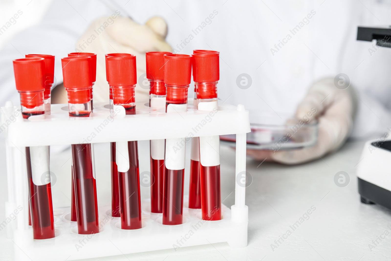 Photo of Test tubes with blood samples on table in laboratory. Virus research