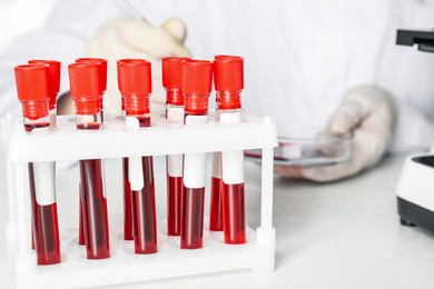 Test tubes with blood samples on table in laboratory. Virus research