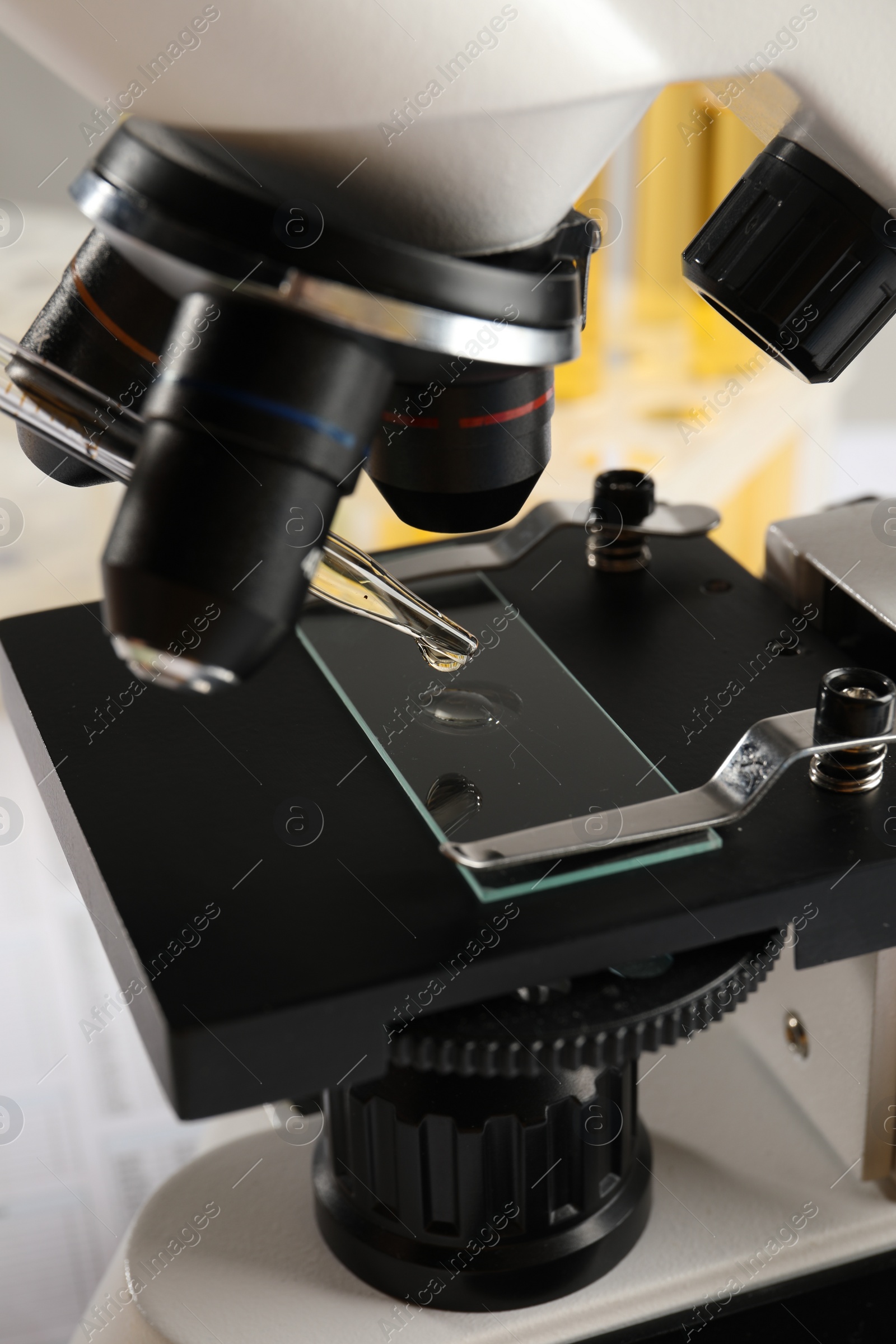 Photo of Microscope with drop of urine on glass slide, closeup