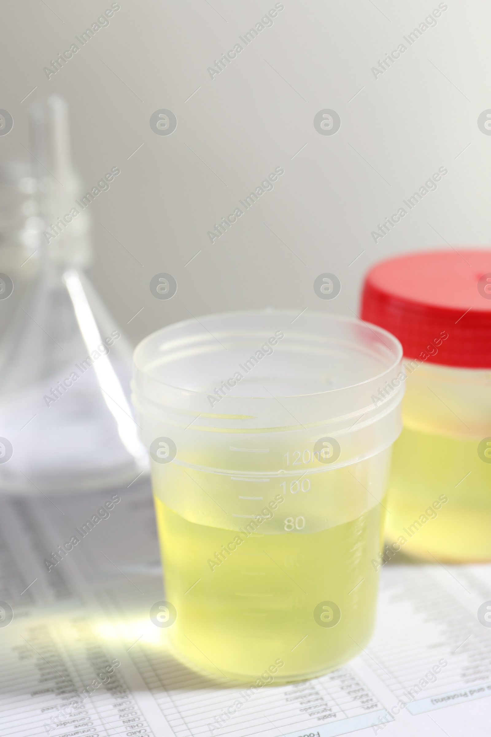 Photo of Containers with urine samples for analysis and glassware on test forms in laboratory