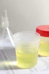 Photo of Containers with urine samples for analysis and glassware on test forms in laboratory