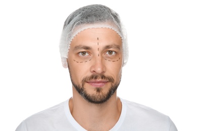 Portrait of mature man with marks on face preparing for cosmetic surgery against white background