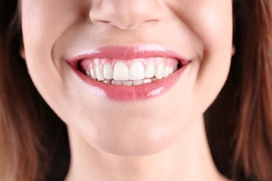 Young smiling woman with healthy teeth, closeup