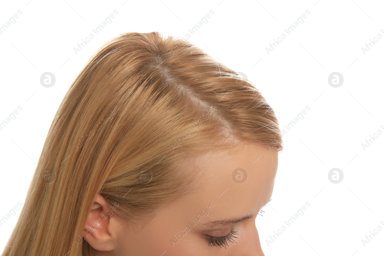 Photo of Woman with hair loss problem on white background, closeup. Trichology treatment