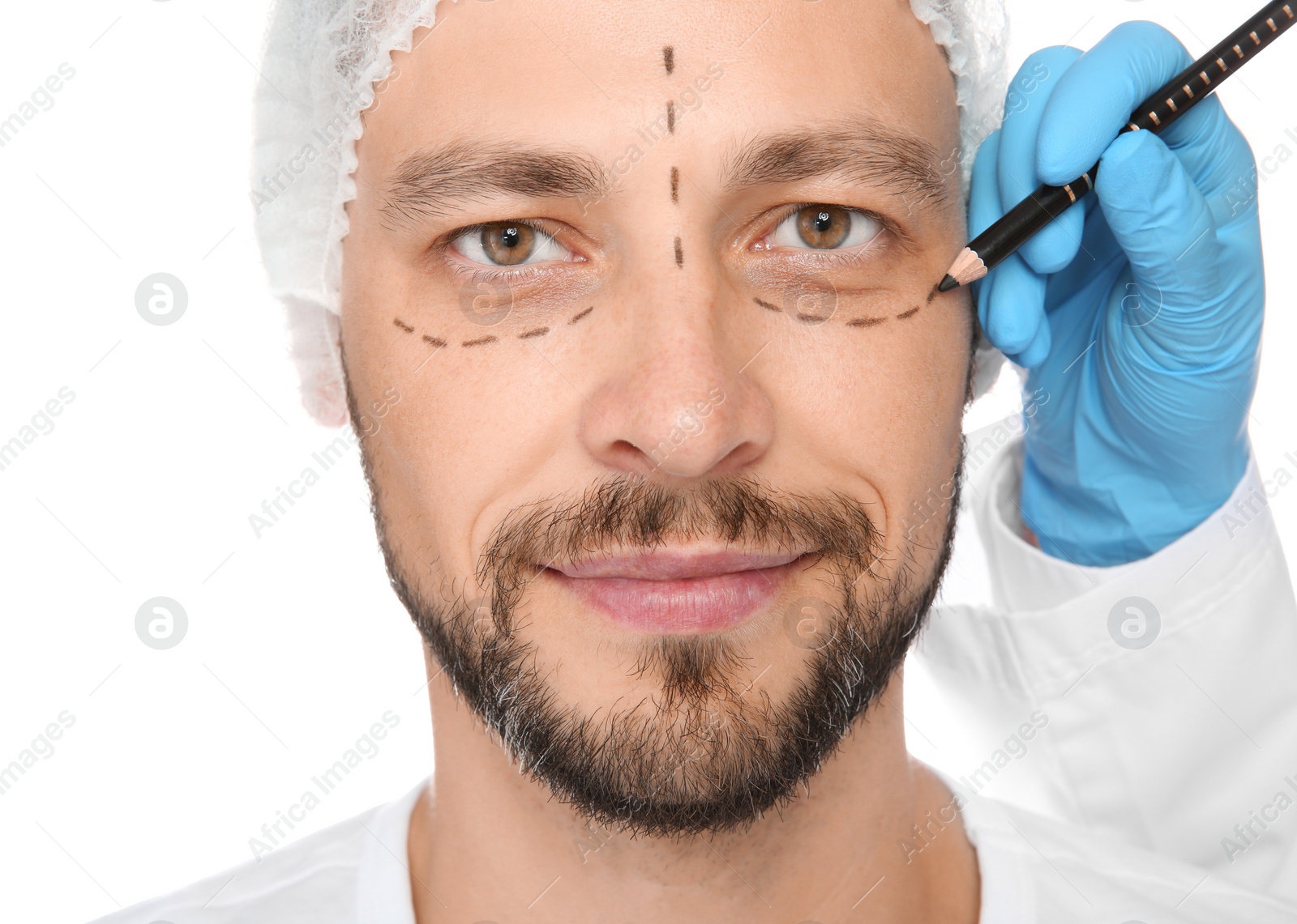 Photo of Doctor marking mature man face before cosmetic surgery on white background