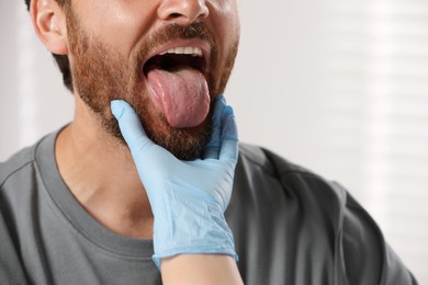 Doctor in medical gloves examining man`s oral cavity on blurred background, closeup