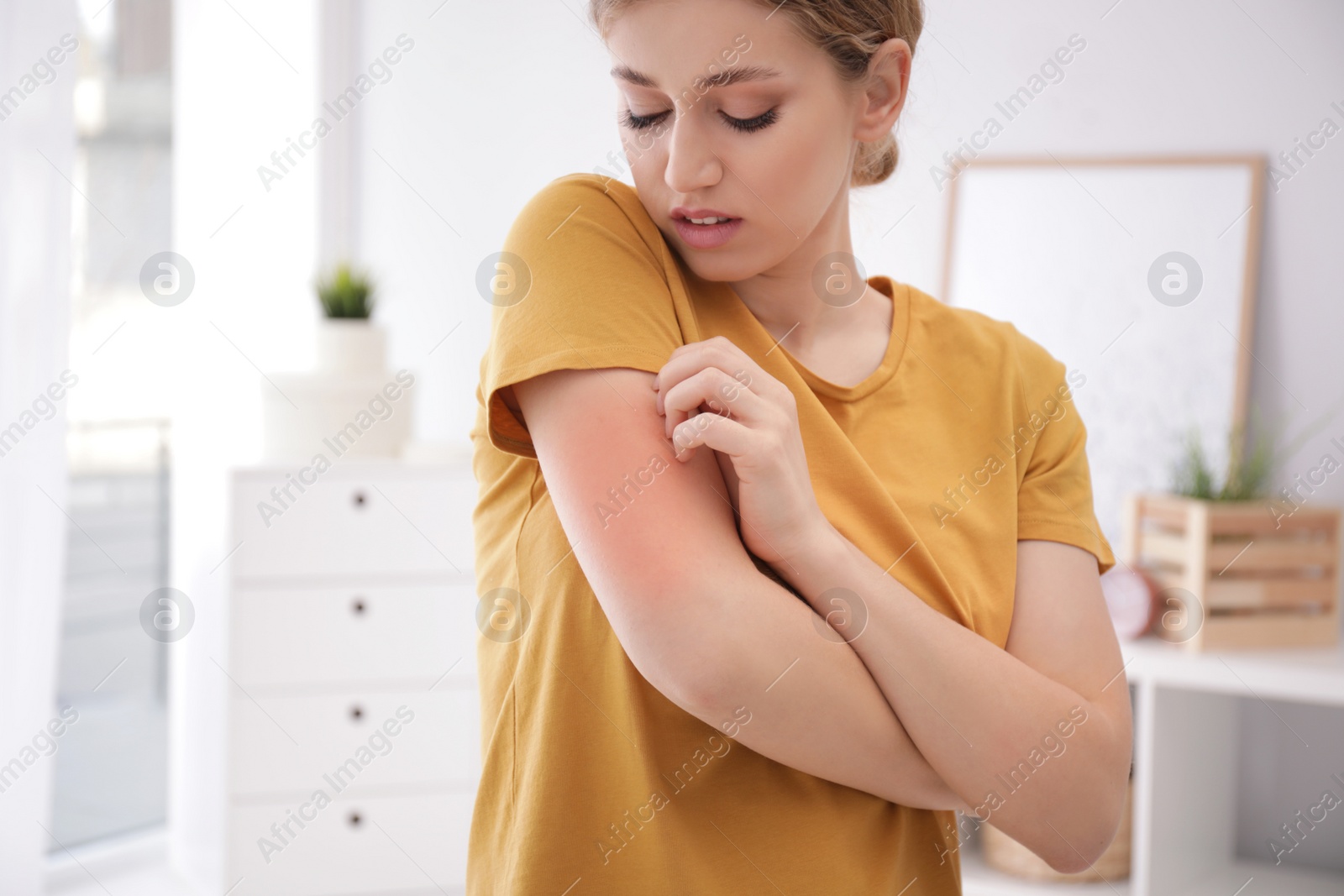 Photo of Woman scratching arm indoors, space for text. Allergy symptoms