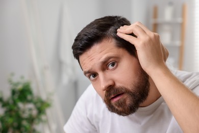 Photo of Man with dandruff in his dark hair at home, space for text
