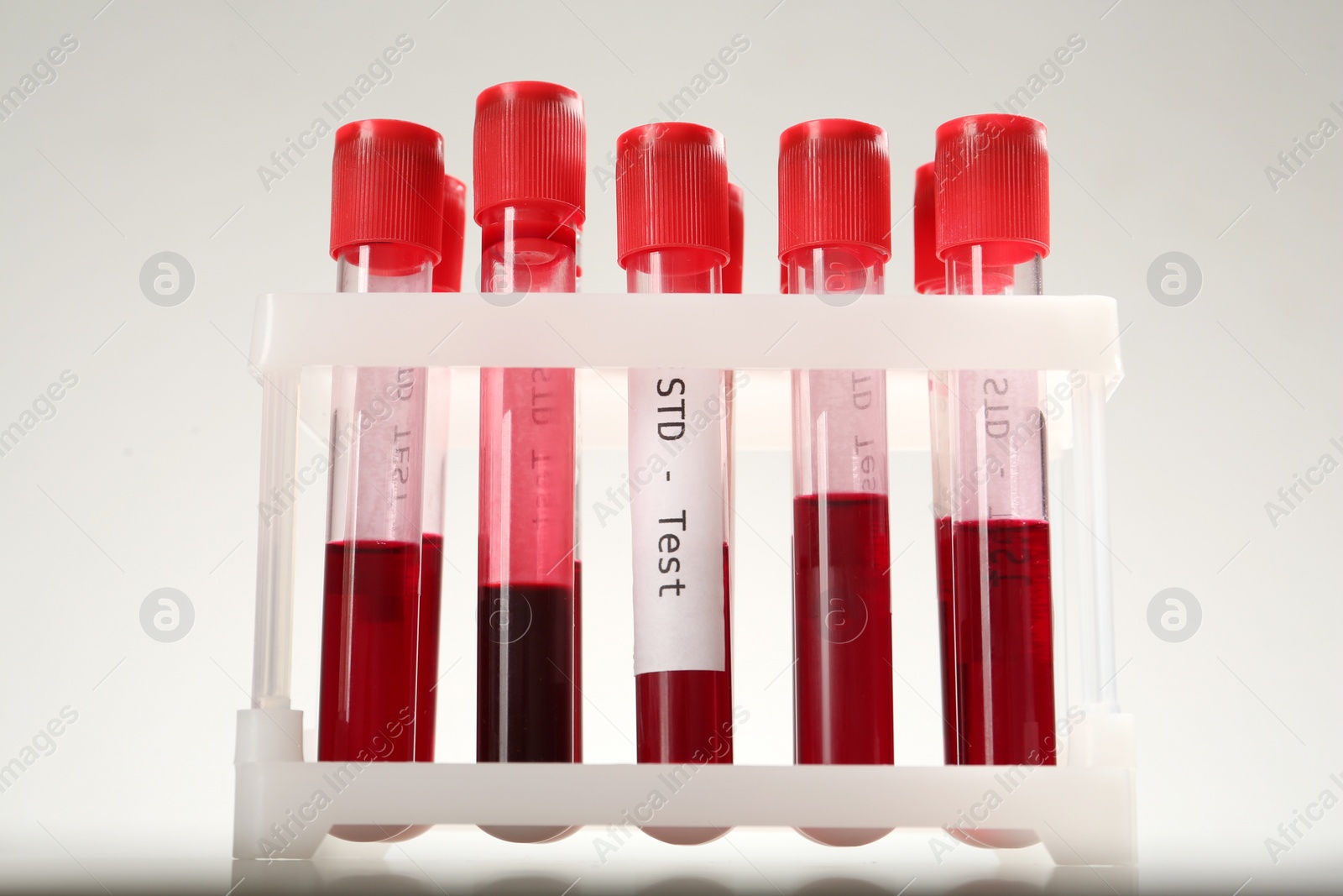 Photo of Tubes with blood samples in rack on white background. STD test