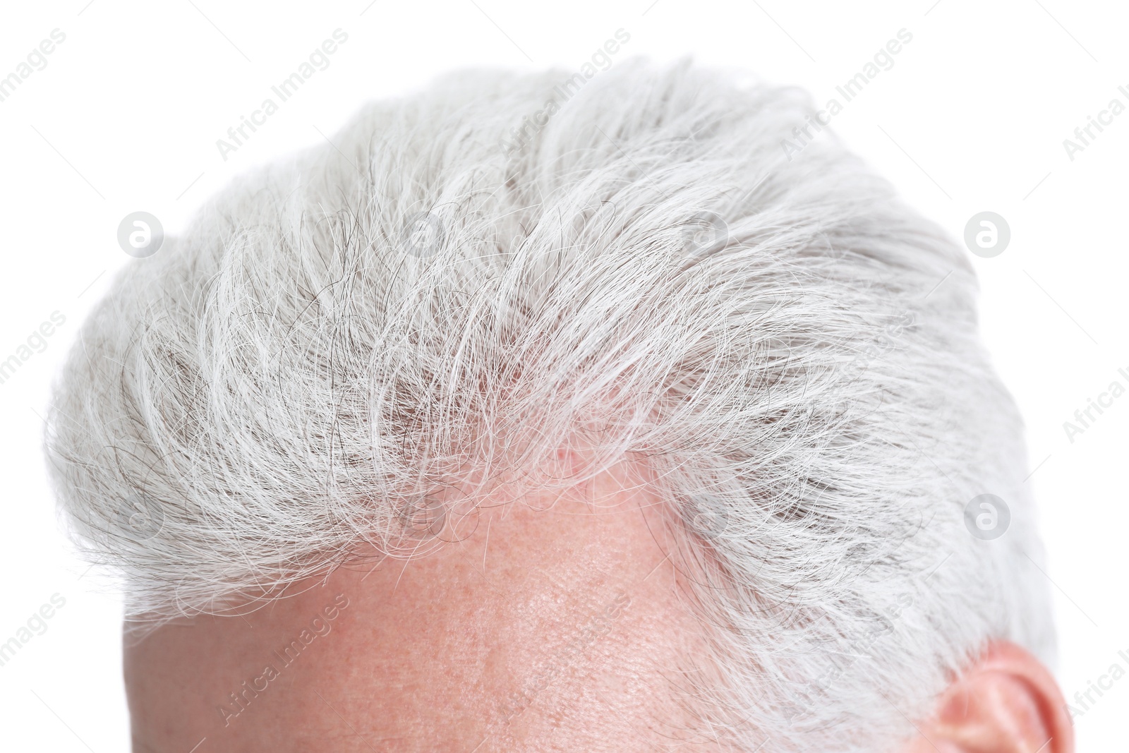 Photo of Senior man with hair loss problem isolated on white, closeup