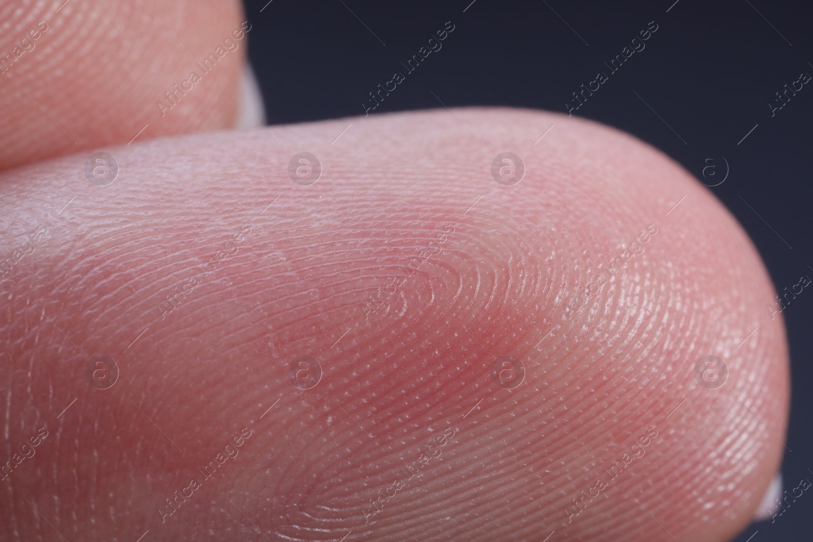 Photo of Finger with friction ridges on dark background, macro view