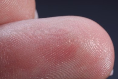 Photo of Finger with friction ridges on dark background, macro view