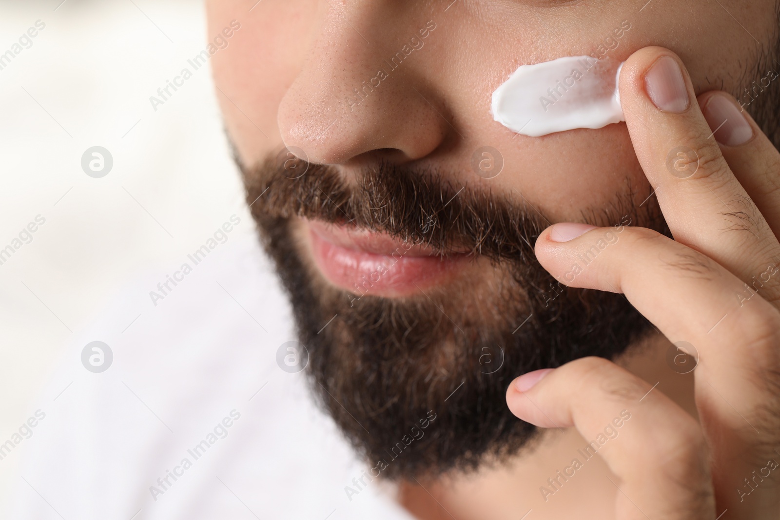 Photo of Man with dry skin applying cream onto his face on light background, closeup