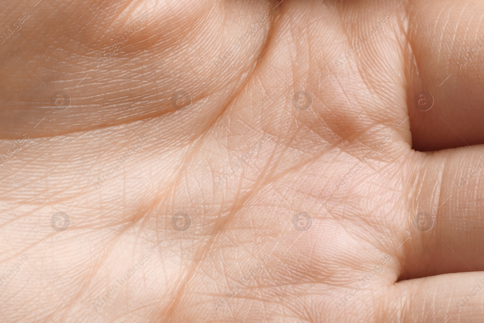 Photo of Closeup view of woman's palm with normal skin