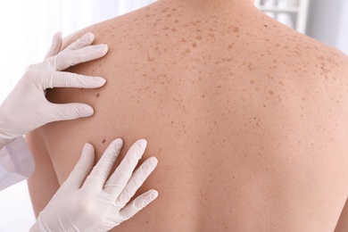 Photo of Doctor examining patient in clinic. Visiting dermatologist