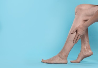 Closeup view of woman suffering from varicose veins on light blue background. Space for text