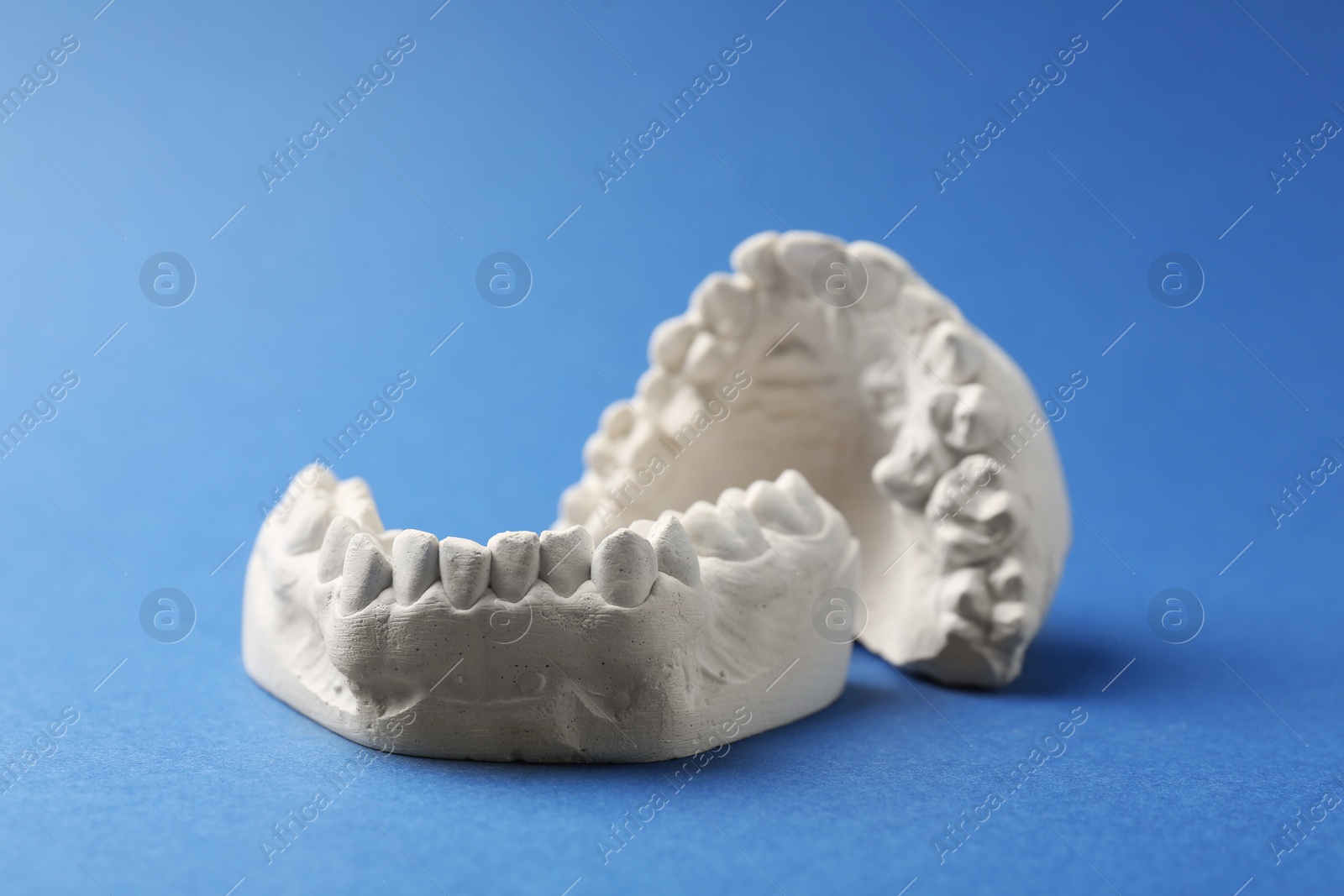 Photo of Dental model with gums on blue background. Cast of teeth