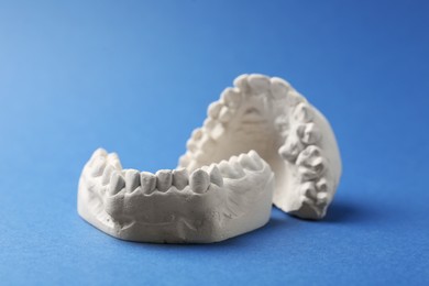 Dental model with gums on blue background. Cast of teeth