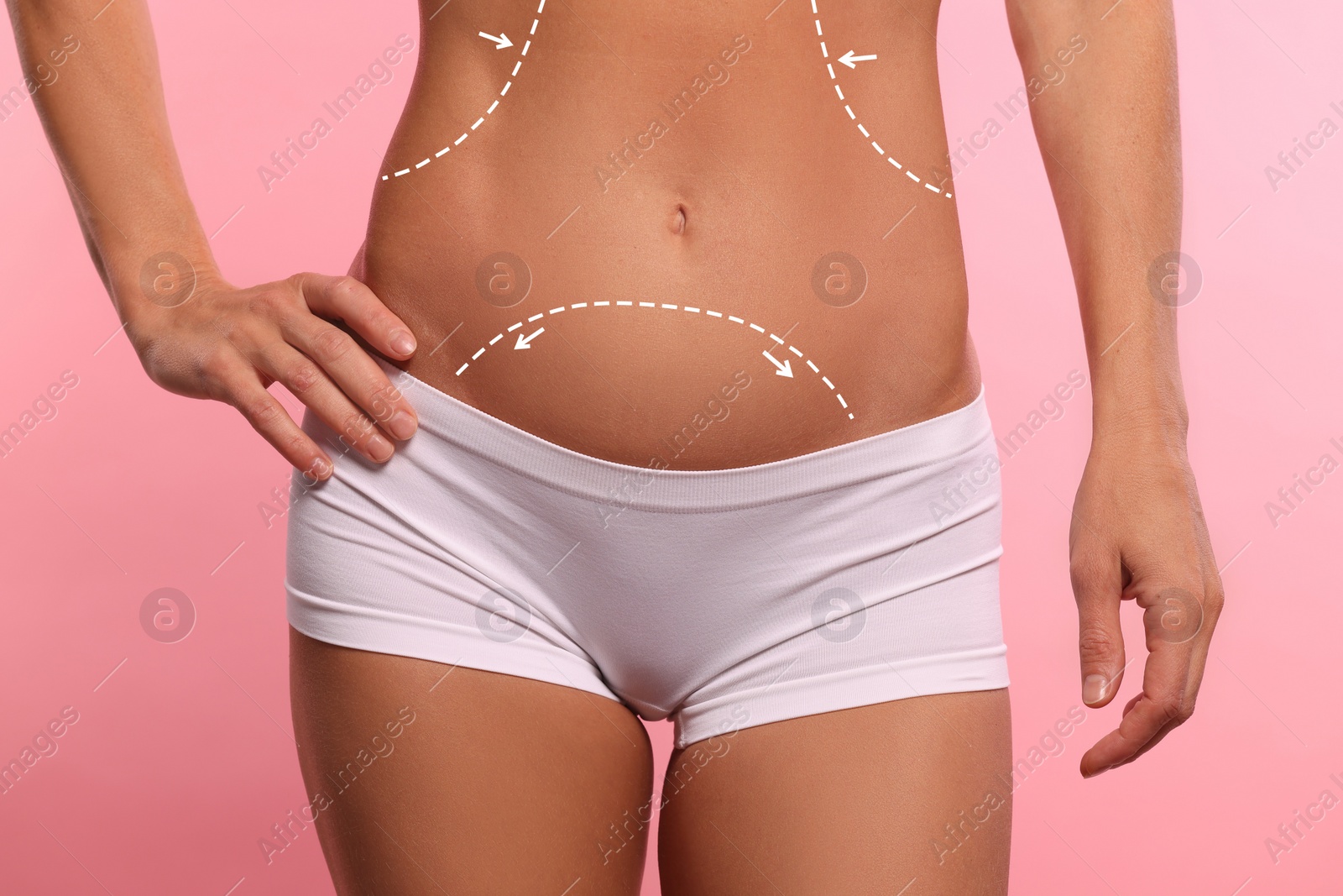 Image of Woman with markings for cosmetic surgery on her abdomen against pink background, closeup