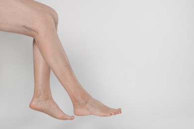 Closeup view of woman with varicose veins on light background. Space for text