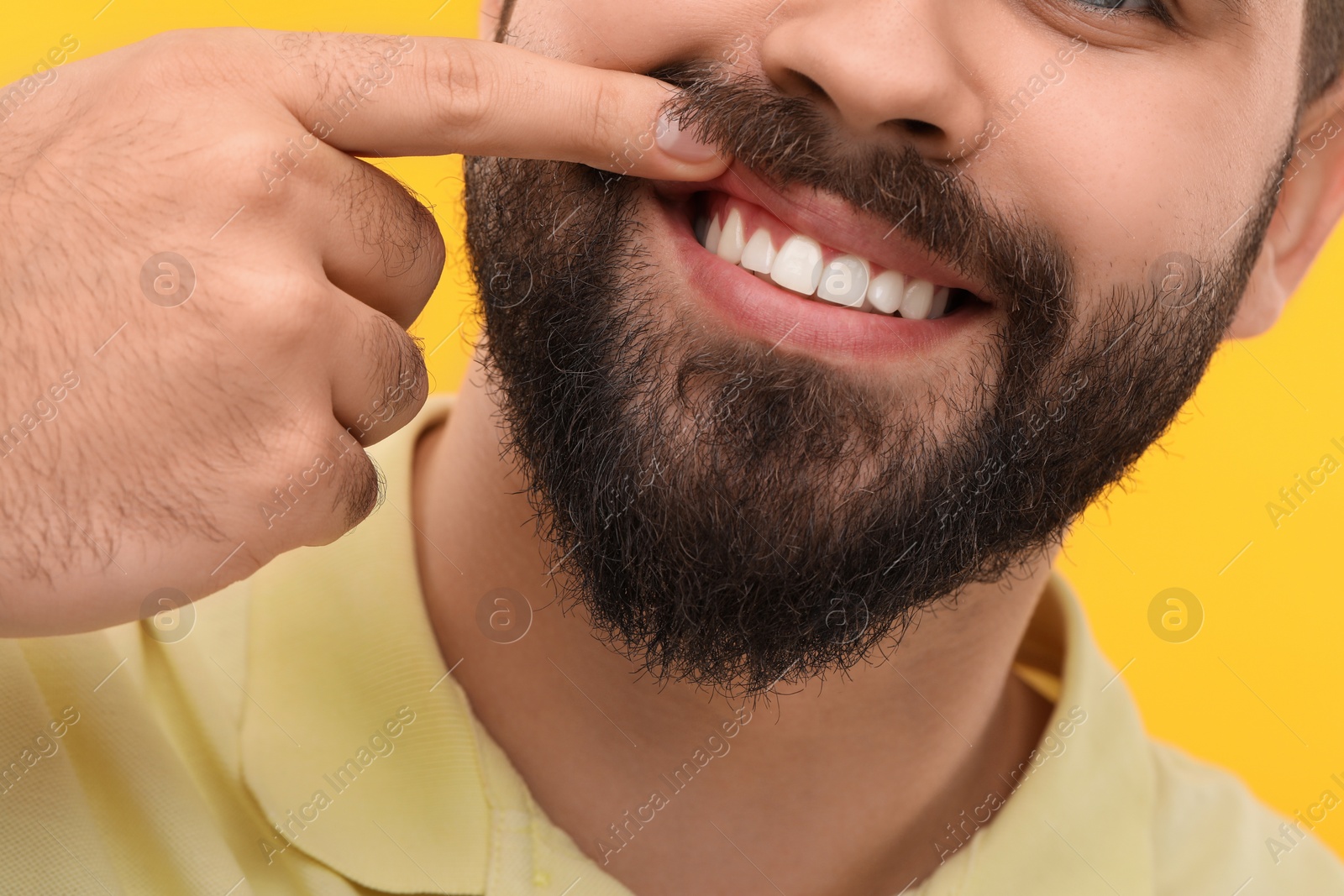 Photo of Man showing his clean teeth on yellow background, closeup