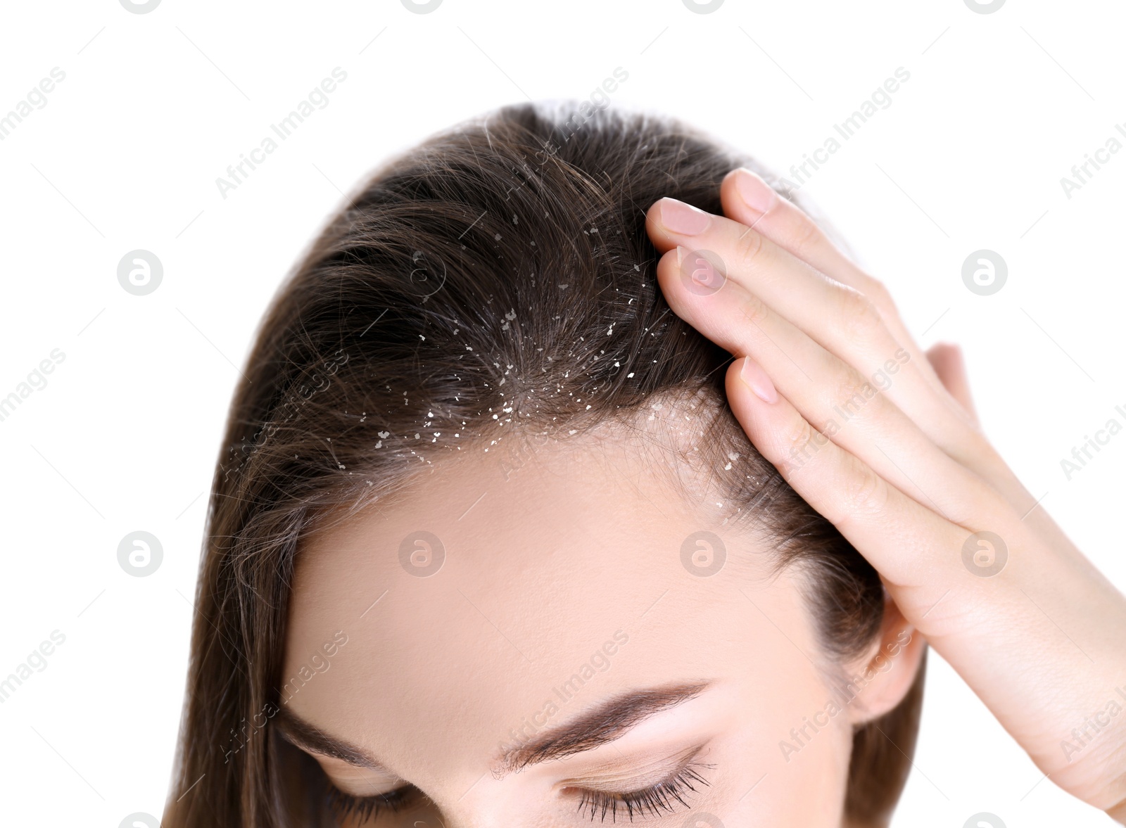 Image of Woman with dandruff in her hair on white background, closeup