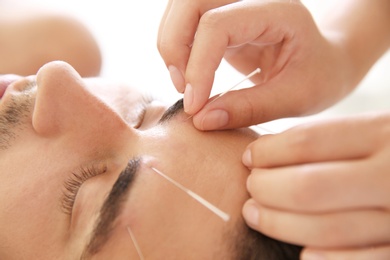 Photo of Young man undergoing acupuncture treatment in salon, closeup