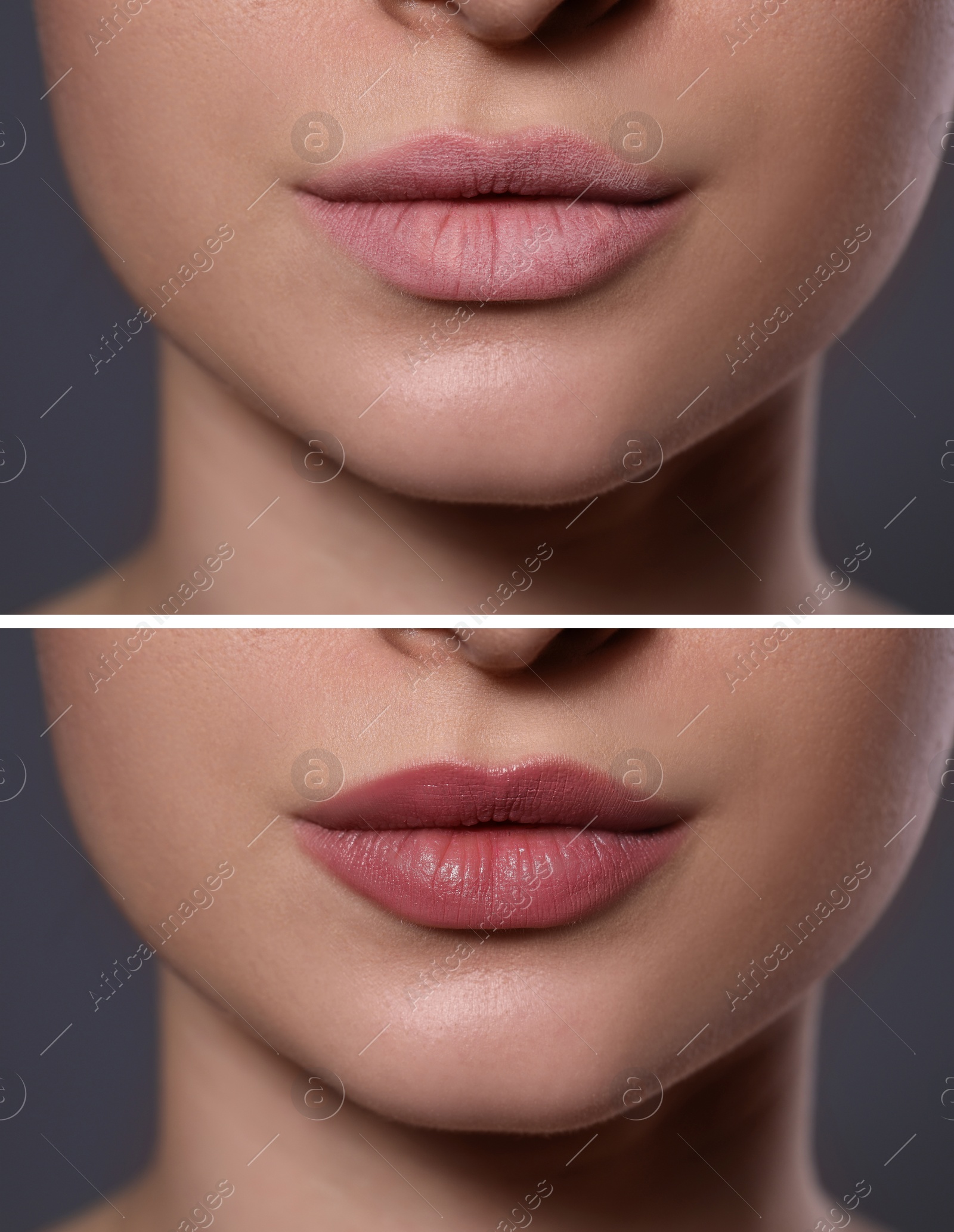 Image of Collage with photos of woman with dry and moisturized lips, closeup