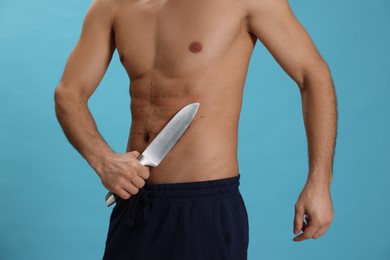 Fit man with knife and marks on body against light blue background, closeup. Weight loss surgery