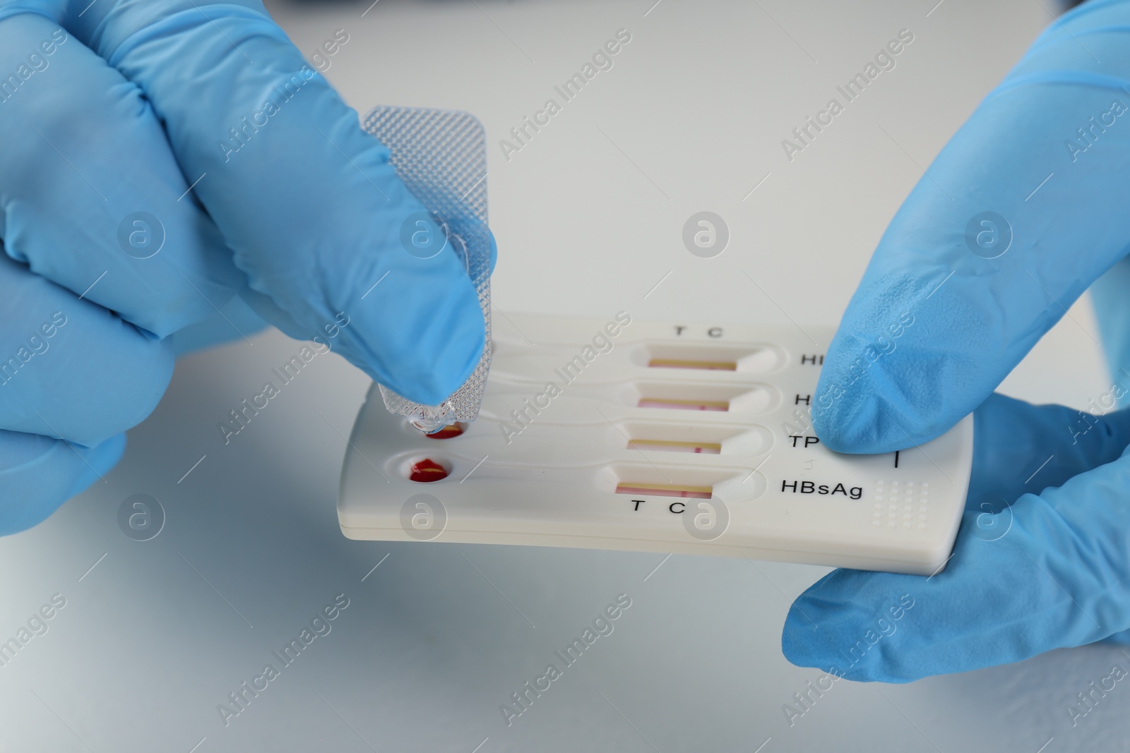 Photo of Doctor dropping buffer solution onto disposable multi-infection express test cassette at white table, closeup