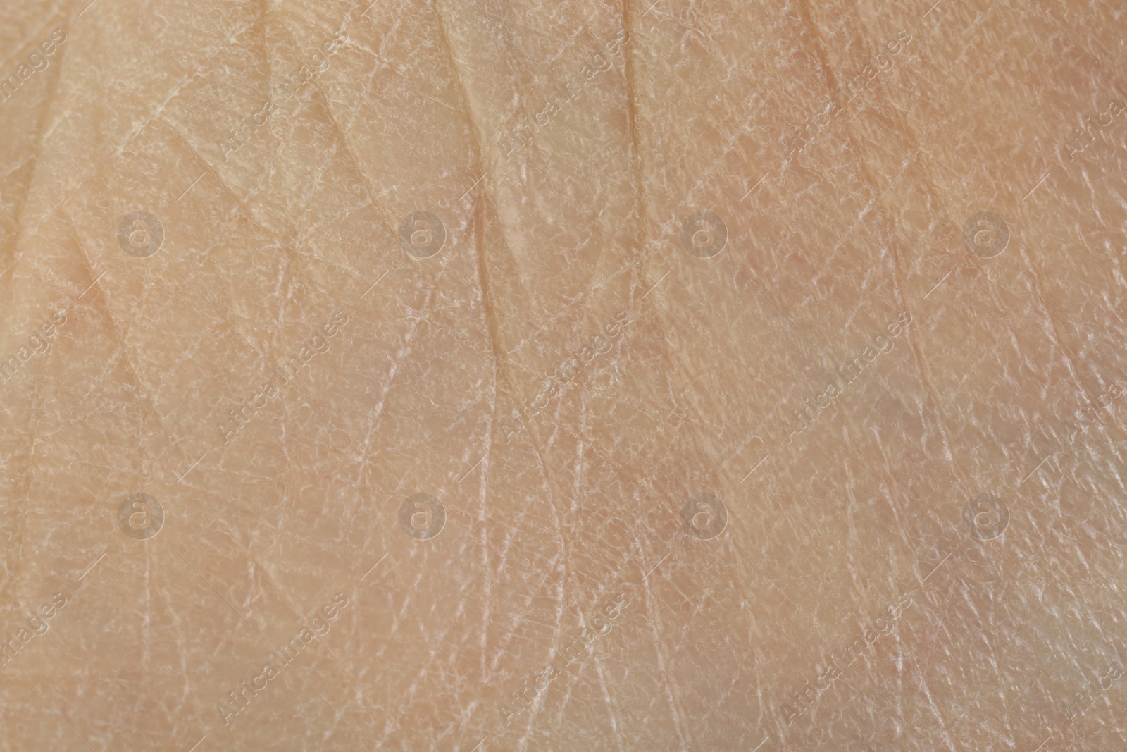 Photo of Texture of dry skin as background, macro view