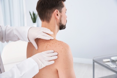 Photo of Dermatologist examining patient's birthmark in clinic