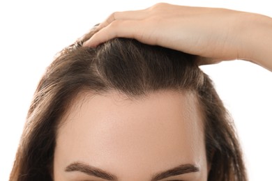 Woman suffering from baldness on white background, closeup