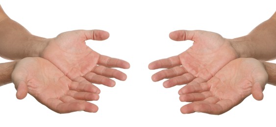 Image of Man showing hands without and with calluses on white background., closeup. Collage 