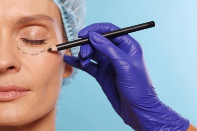 Photo of Doctor with pencil preparing patient for cosmetic surgery operation on light blue background, closeup