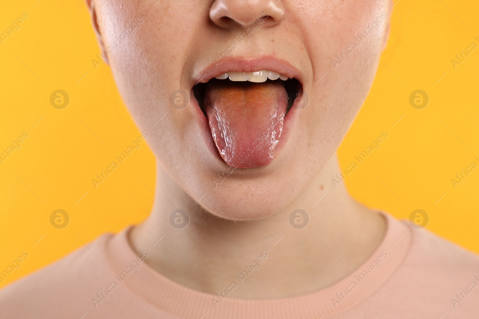 Photo of Gastrointestinal diseases. Woman showing her yellow tongue on color background, closeup