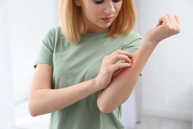Photo of Woman with allergy symptoms scratching forearm indoors, closeup