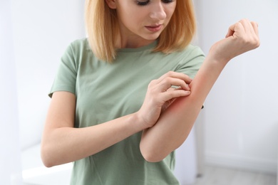 Woman with allergy symptoms scratching forearm indoors, closeup