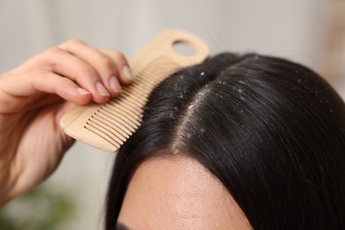 Woman with comb examining her hair and scalp on blurred background, closeup. Dandruff problem