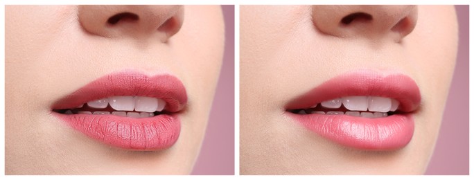 Image of Collage with photos of woman before and after using lip balm on pink background, closeup