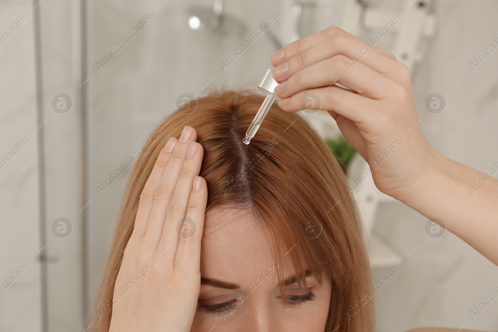 Photo of Woman applying oil onto hair at home, closeup. Baldness problem