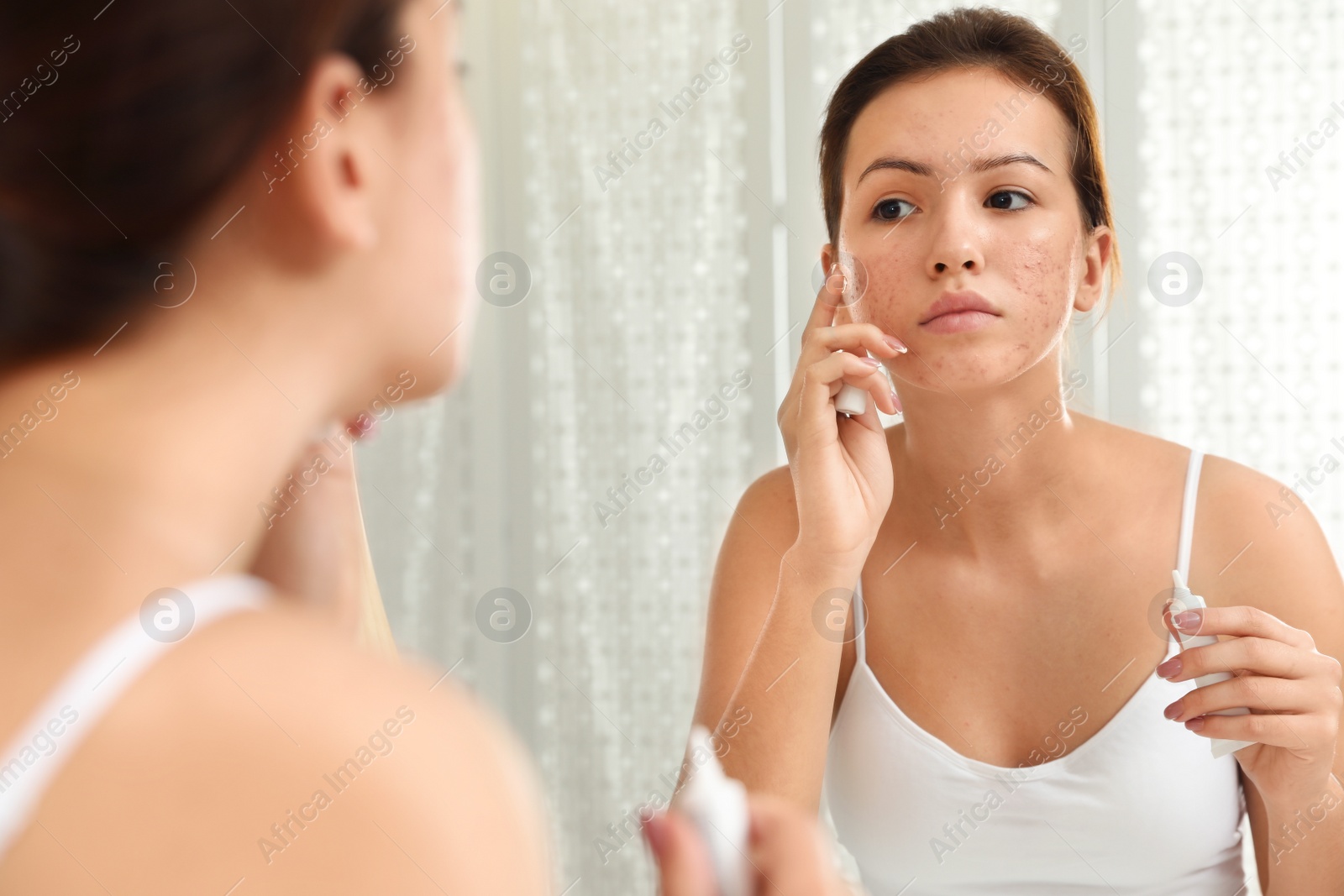 Photo of Teen girl with acne problem applying cream near mirror in bathroom